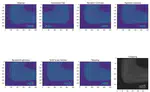 Deep Transfer Learning-Based Musculoskeletal Abnormality Detection